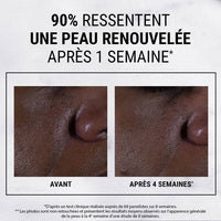 Kiehl's - Ultra Pure High-Potency Glycolic