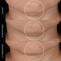 Lancôme Rénergie - Crème H.P.N 300-Peptide Anti-Age