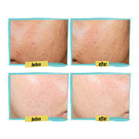 Kiehl's - Expertly Clear Blemish-Treating & Preventing Lotion