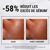 Kiehl's - Niacinamida ultrapura de alta potencia