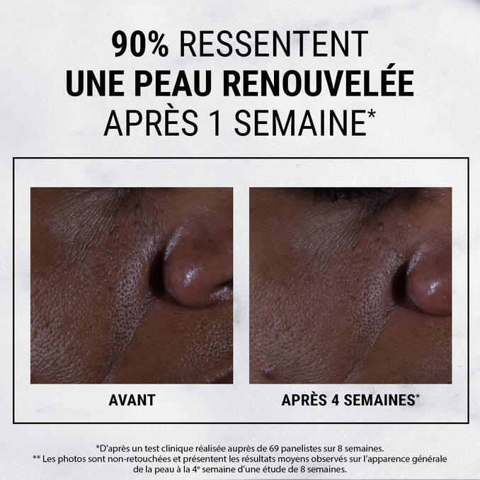 Kiehl's - Ultra Pure High-Potency Glycolic