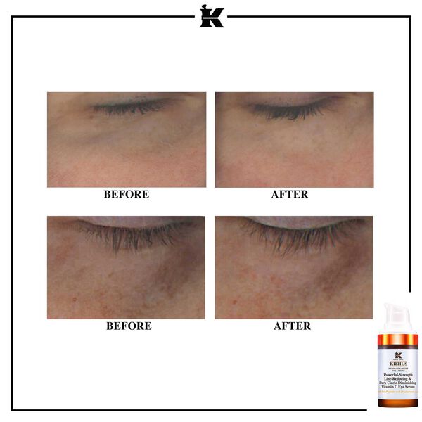 Kiehl’s - Powerful-Strength Line-Reducing & Dark Circle-Diminishing Vitamin C