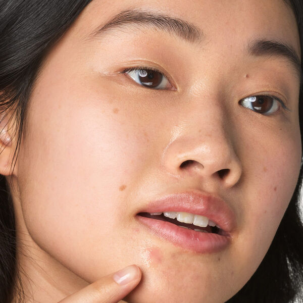 Kiehl's - Solución Truly Targeted Blemish Clearing Solution