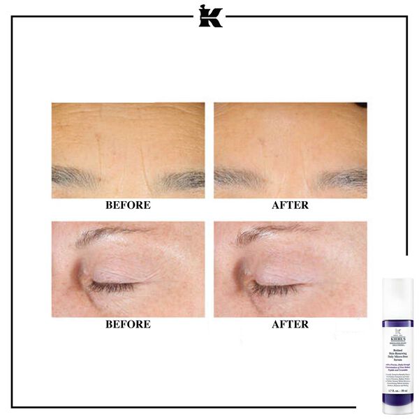 Kiehl’s - Retinol Skin-Renewing Daily Micro-Dose Serum