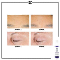 Kiehl’s - Retinol Skin-Renewing Daily Micro-Dose Serum