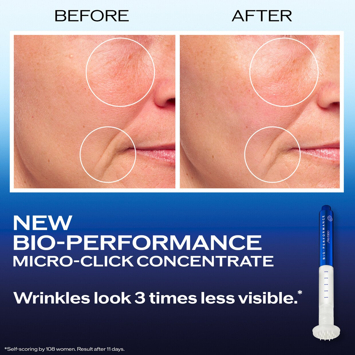 Shiseido Micro-Click Soin Concentré