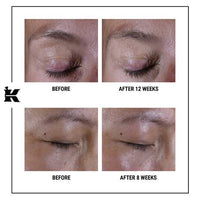 Kiehl's - Super Multi-Corrective Eye Zone Treatment
