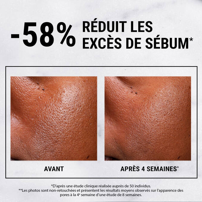 Kiehl's - Niacinamida ultrapura de alta potencia