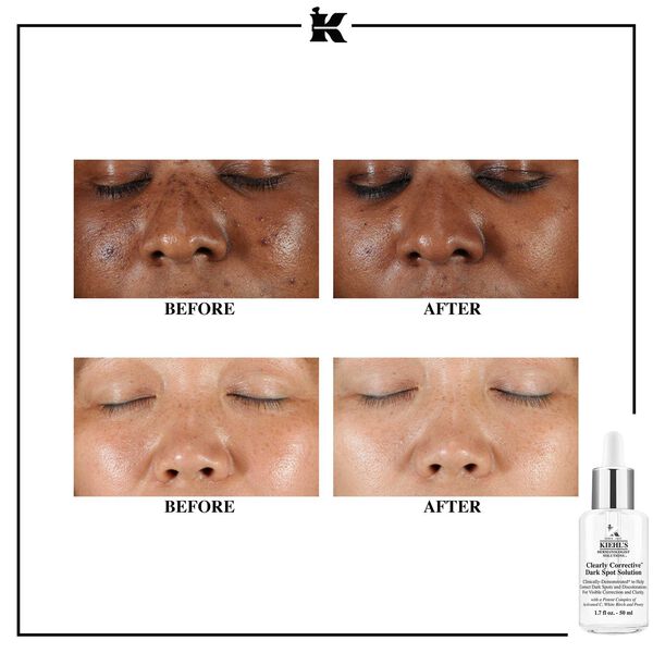 Kiehl's - Clearly Corrective™ Dark Spot Solution