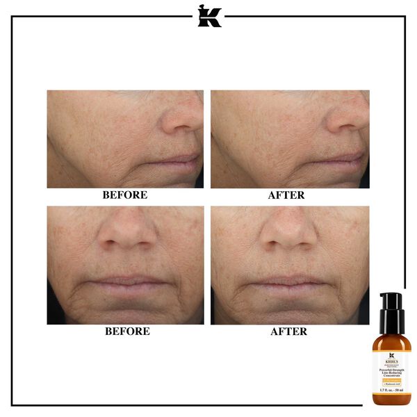 Kiehl's - Concentrado Reductor de Líneas Potente