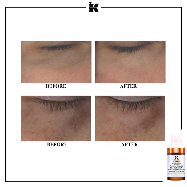 Kiehl's - Vitamina C, potente forza per ridurre le rughe e le occhiaie