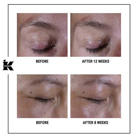 Kiehl's - Trattamento Super Multi-Correttivo Zona Occhi
