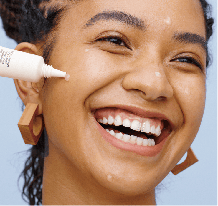 Shiseido WASO Trattamento mirato SOS per le imperfezioni