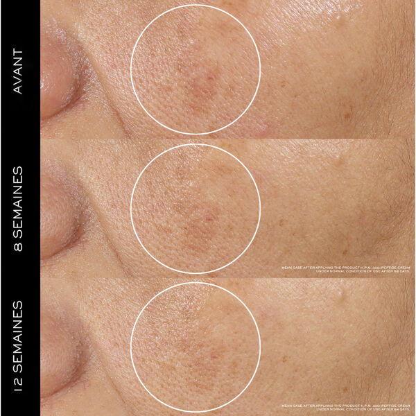 Lancôme Rénergie - H.P.N 300-Peptide Anti-Aging Crème
